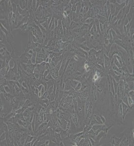 DLD-1人結(jié)直腸腺癌上皮細(xì)胞主圖
