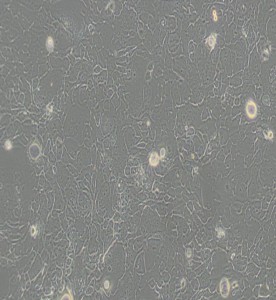 SW 1990人胰腺癌細(xì)胞(L15） 主圖